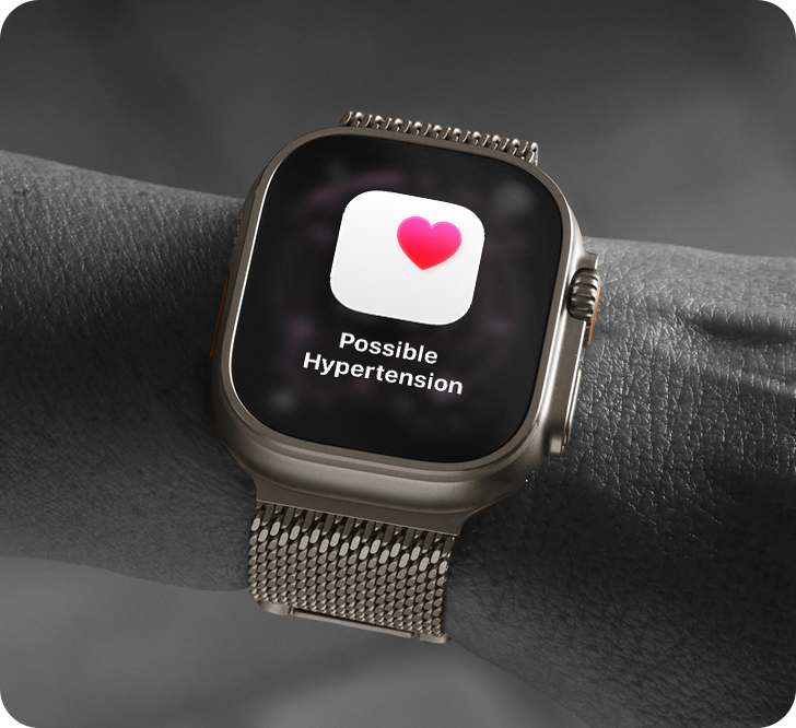 Apple Watch Ultra 3
